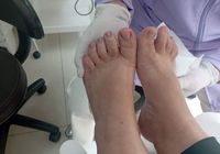 Podologia tratamento dos pés... ANúNCIOS Bonsanuncios.pt